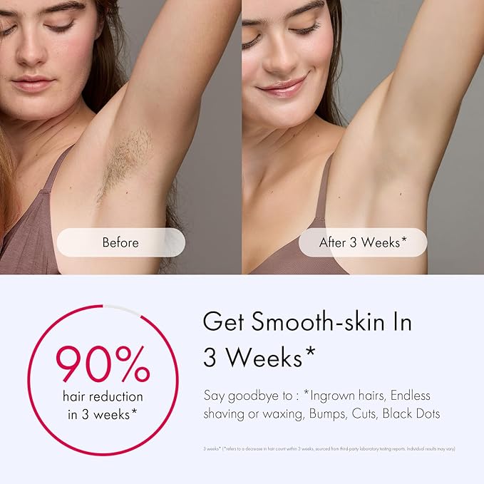Ulike Laser Hair Removal for Women and Men, Air 3 Ice-Cooling IPL Hair Removal Device for Nearly Painless & Long-Lasting Results, 3 Modes & Auto Flashing for Fast Full Body Hair Removal from Home